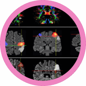 RM Funcional: De la Teoría a la Práctica Clínica en neurociencias