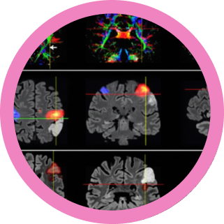 RM Funcional_ De la Teoría a la Práctica Clínica en neurociencias