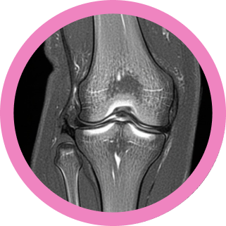 RM de Rodilla_ Más Allá del Informe Radiológico