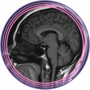 Neuroimágenes para el radiólogo general